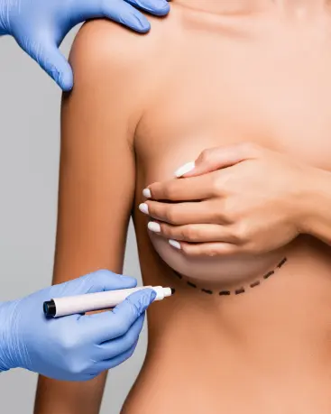 Breast Surgery Image